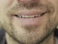Un sourire d'homme barbu, peut-être réfléchissant au coût des études de dentiste pour un avenir radieux.
