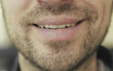Un sourire d'homme barbu, peut-être réfléchissant au coût des études de dentiste pour un avenir radieux.