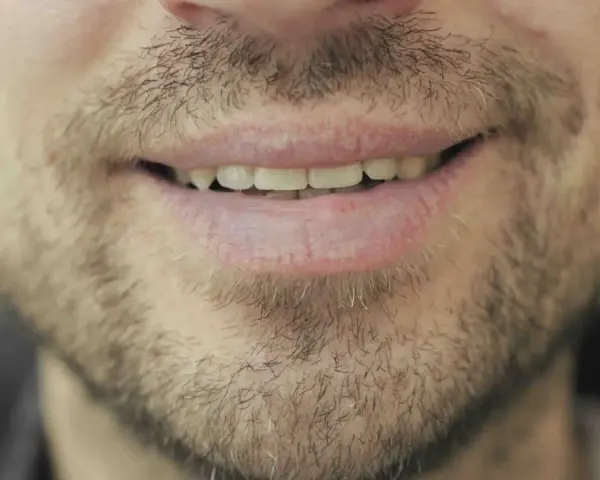 Un sourire d'homme barbu, peut-être réfléchissant au coût des études de dentiste pour un avenir radieux.